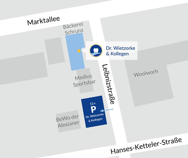 Skizze für die Parkplätze